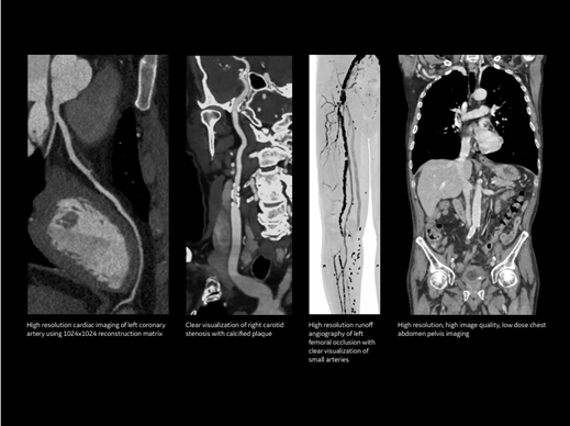 máy chụp cắt lớp vi tính GE Revolution Maxima